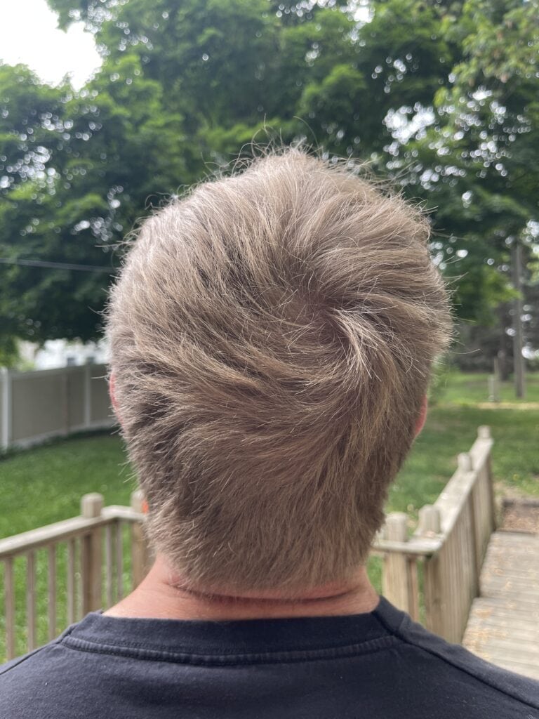musely review: before and after pics