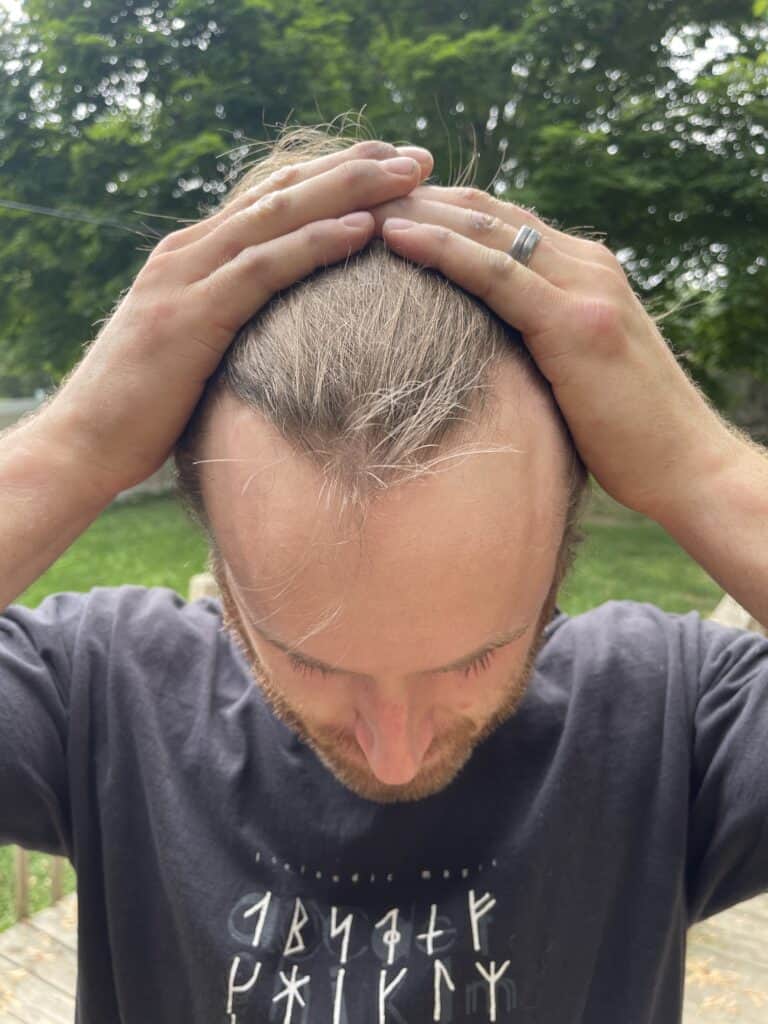 musely review: before and after pics