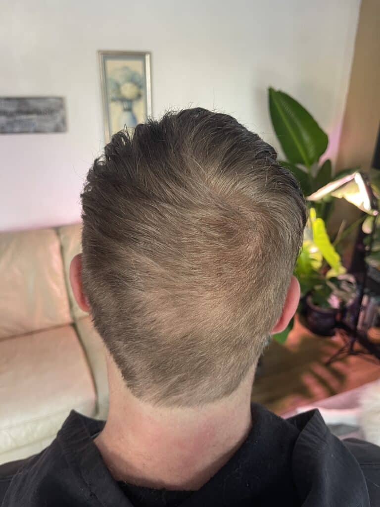 musely review: before and after pics
