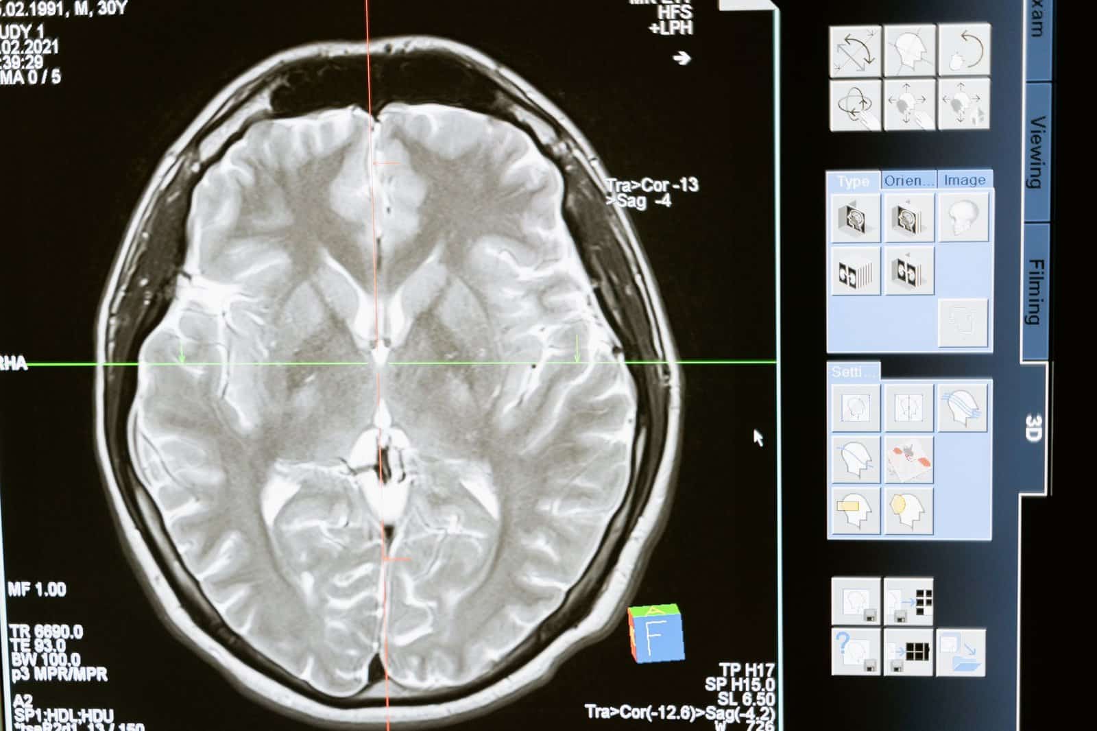 travel neuroscience travel scene